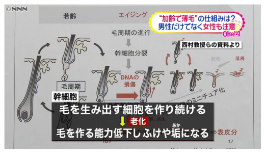 今日の気になるニュース。薄毛になるメカニズムが解明。